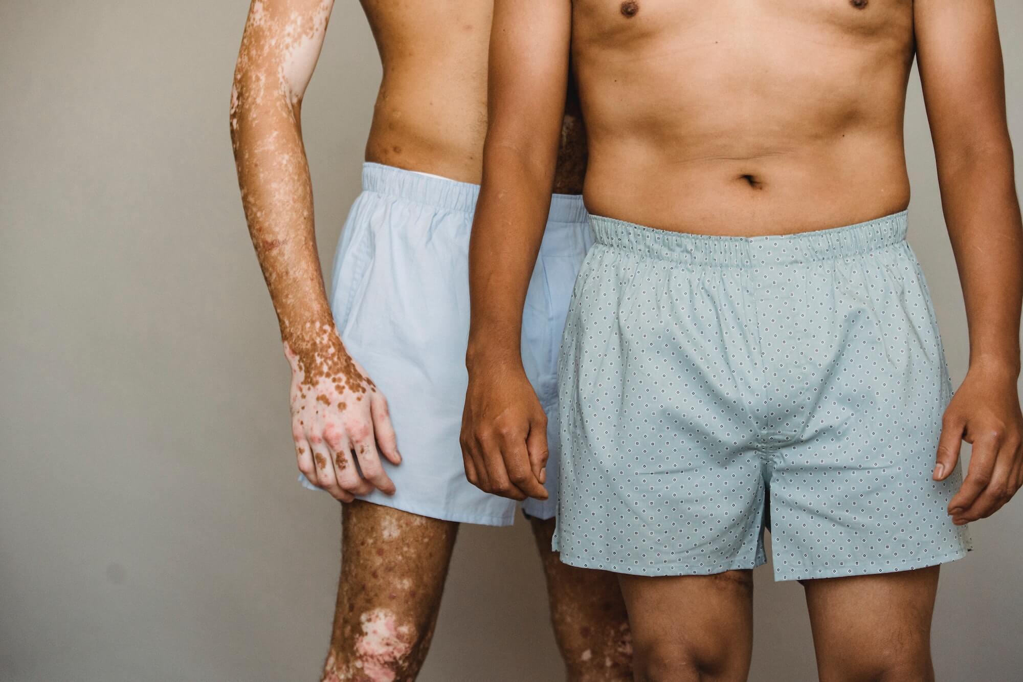 Two men in boxer shorts